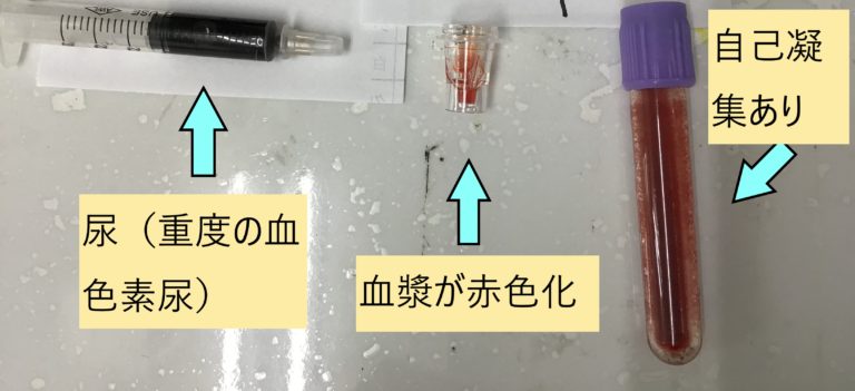 特発性AIHAの症状